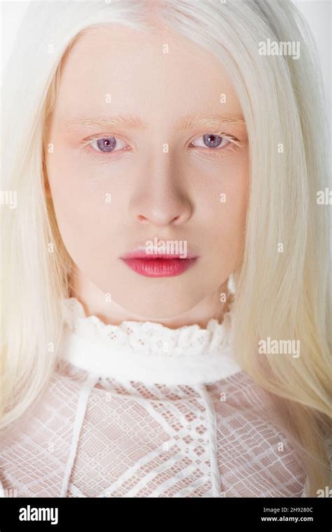 Portrait Of Albino Woman Looking At Camera Isolated On White Stock