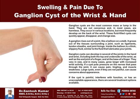 What Helps With Ganglion Cyst Surgery Margaret Greene Kapsels