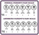 Any New Treatments For Psoriatic Arthritis Pictures