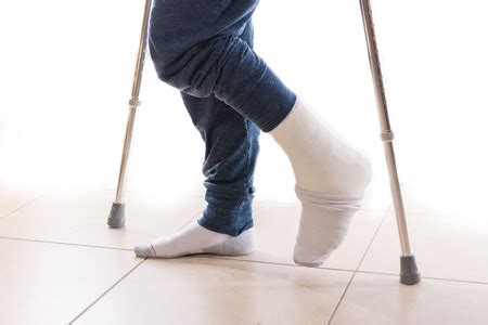 Experiencing big toe pain can also cause pain when walking, swelling in the toe, or discoloration of the big toe. Broken Toe Symptoms, Signs, Treatment, and Healing Time.