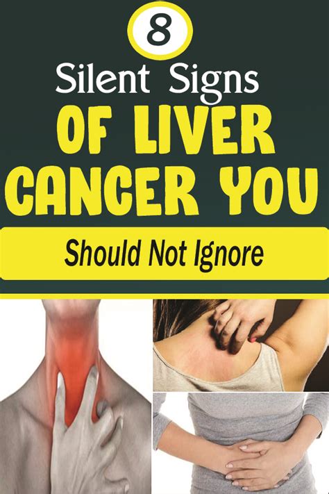 8 Silent Signs Of Liver Cancer You Should Not Ignore Office Health
