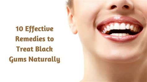 10 Effective Remedies To Treat Black Gums Naturally