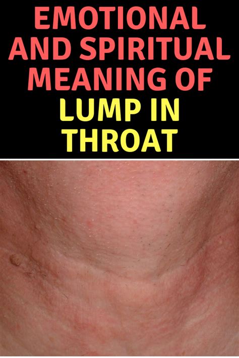 Tonsillitis Lump In Throat Strep Throat Spiritual Meaning