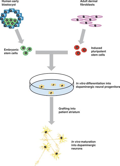 Figure 1 Approaches To Stem Cell Derived Neural Grafting In Parkinson