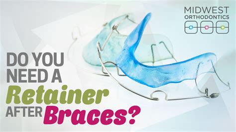 It can range from none, limited, prolonged to permanent. Midwest Orthodontics Center Blog | Smiles Perfected