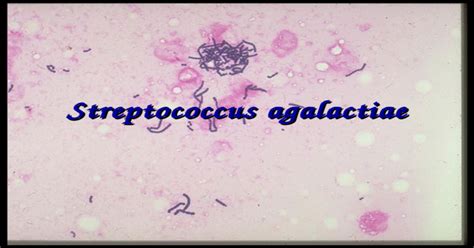 Streptococcus Agalactiae [ppt Powerpoint]