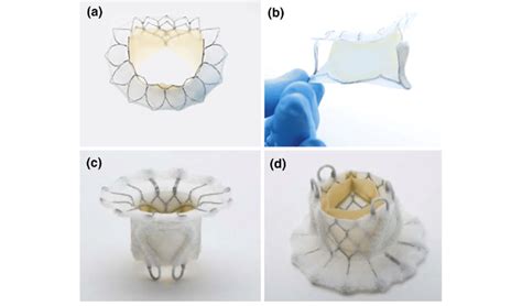 A And B Tiara Tm Catheter Based Mitral Valve Replacement System