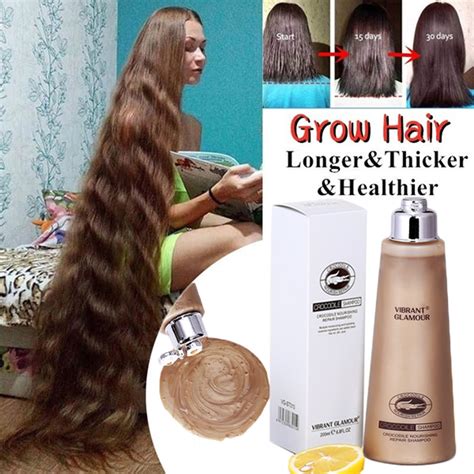 Top 100 Image Best Hair Loss Treatment For Women Vn