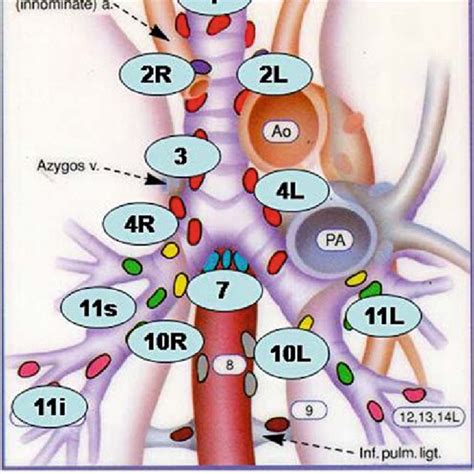 Lymph Node Map Of Lymph Node Stations Numbered Assessable By