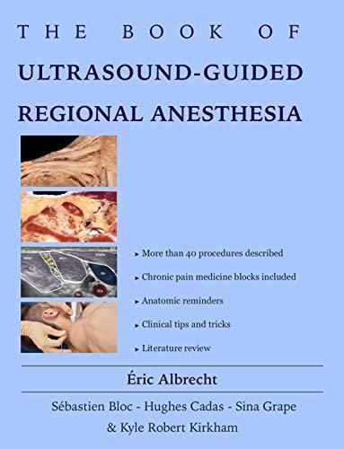 The Book Of Ultrasound Guided Regional Anesthesia By Eric Albrecht