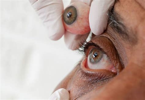 Artificial Eye Discomfort Southeastern Ocularists Inc