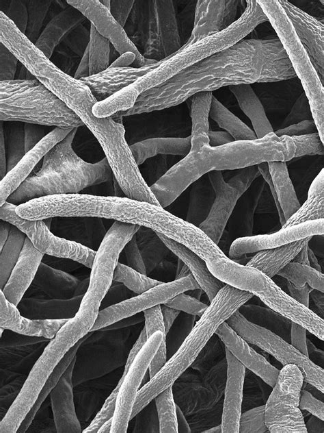 Bracket Fungus Irpex Lacteus Photograph By Dennis Kunkel Microscopy