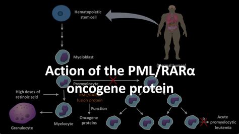 Action Of The Pml Rar Alpha Oncogene Protein Youtube