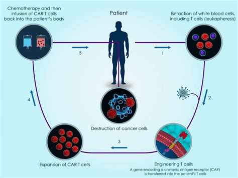 Innovative Car T Cell Cancer Therapy Now Available To Medicare