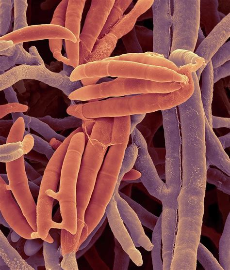 Toxic Fungus Fusarium Sp Photograph By Dennis Kunkel Microscopy