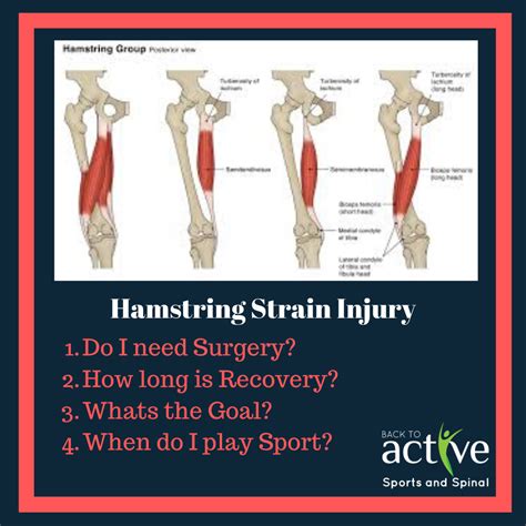Hamstring Injury Diagram