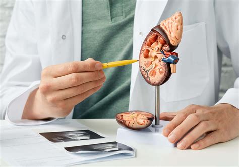 Signs Of Kidney Stones Faq Advanced Urology