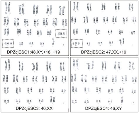 Karyotyping And Determination Of The Sex Karyotype Analysis Of The