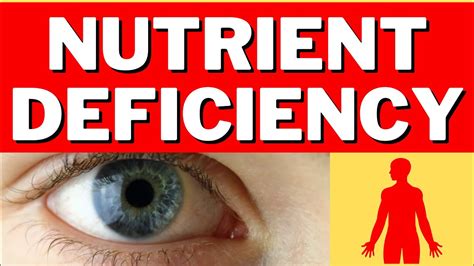Signs Your Body Is Deficient In Nutrients Youtube