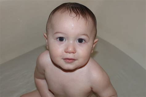 Bulging Above Ears Normal Head Shape Babycenter