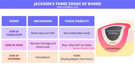 Jacksons Three Zones Of Burns