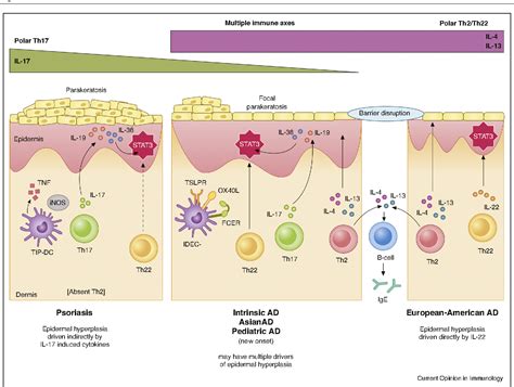 Figure 1 From Atopic Dermatitis And Psoriasis Two Different Immune