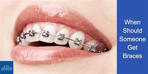 When Should Someone Get Braces La Dental Clinic