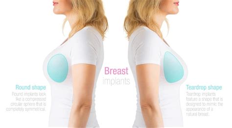 Breast Implant Options Bay Area Esthetics San Francisco