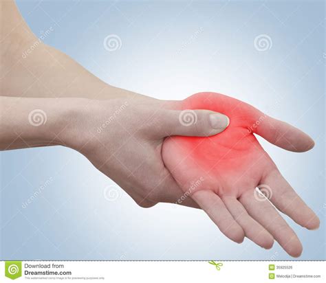 Acute Pain In A Woman Palm Stock Photo Image Of Anatomy 35925526