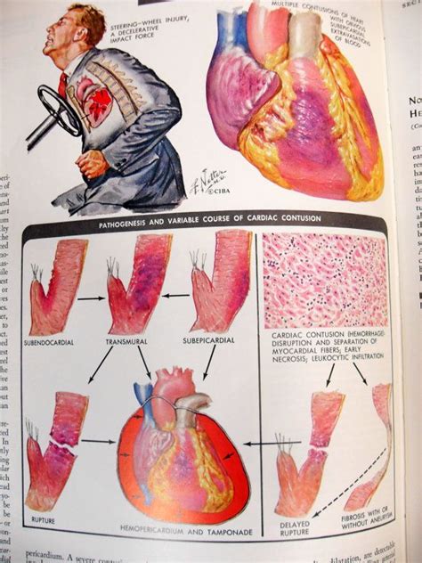 The Ciba Collection Of Medical Illustrations Volume 5 Heart Frank H