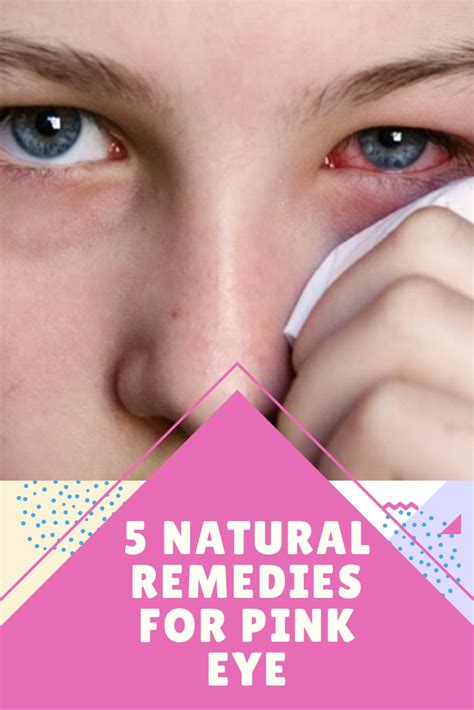 5 Natural Remedies For Pink Eye Health And Fitness