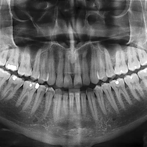 See more ideas about dental, dentistry, radiography. Dental X-Rays: It's Time For Your Close-Up - MT West Dentist