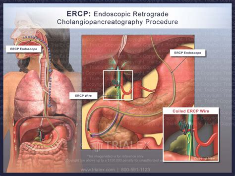 Ercp Endoscopic Retrograde Cholangiopancreatography Procedure