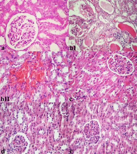 Microscopic Appearance From Kidney Tissues Of The Experimental Rats H