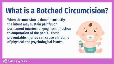 Botched Circumcision Caused By Negligence Birth Injury Guide