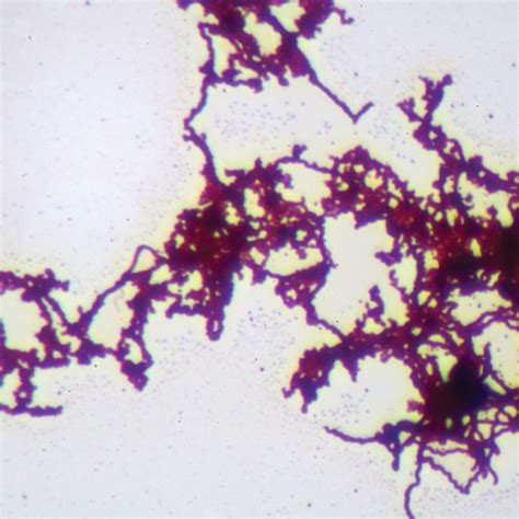 Treponema Wm Microscope Slide Carolina Biological Supply