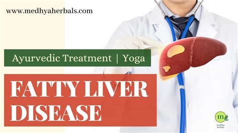 Fatty Liver Treatment Top Ayurvedic Medicines Diet Yoga