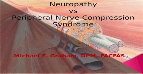 Peripheral Nerve Compression Syndrome Pptx Powerpoint