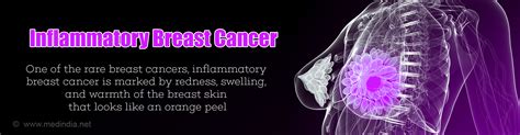inflammatory breast cancer causes symptoms diagnosis treatment and prognosis