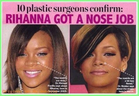 Pin On Celebrity Nose Jobs