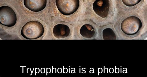 What Is Trypophobia Symptoms And Diagnosis Infographic