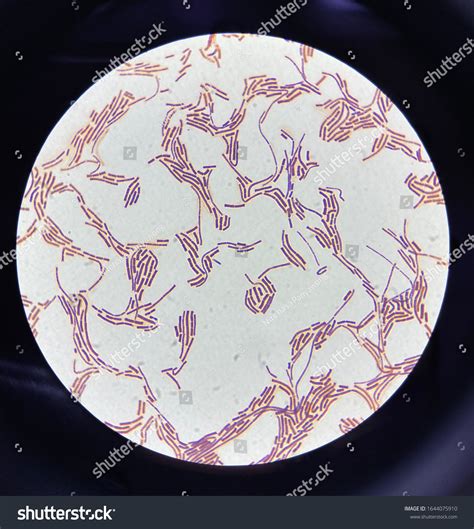 Gram Positive Bacilli Microscope 100x Stock Photo 1644075910 Shutterstock