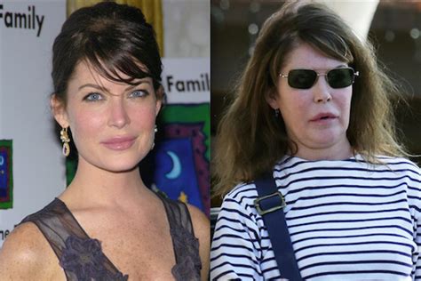 Famous Actresses Who Are Unrecognizable After Plastic Surgery