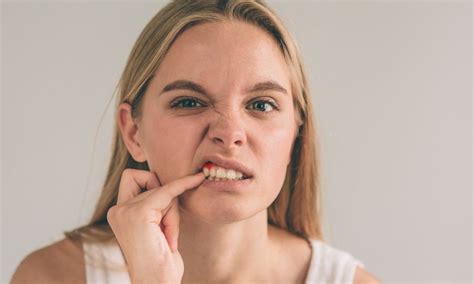 Understanding Gingivitis Causes Symptoms And Treatments Informed Explorer