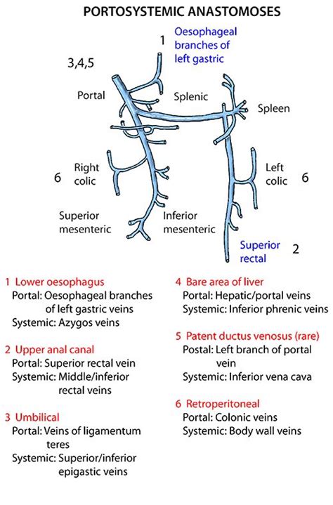 Portacaval Anastomosis Medical Anatomy Diagnostic Medical Sonography