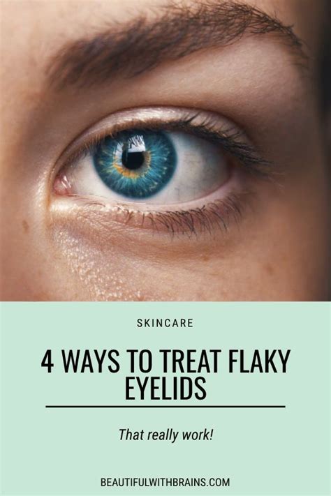 4 Ways To Treat Flaky Eyelids Dry Flaky Eyelids Dry Eyelids Dry