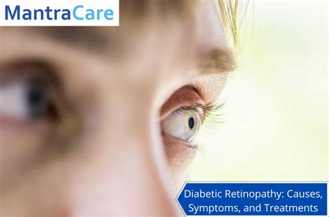 Diabetic Retinopathy Causes Symptoms And Treatment