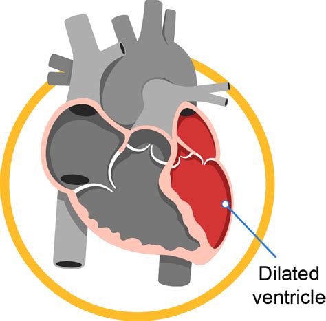 Heart Failure Gleneagles Hospitals