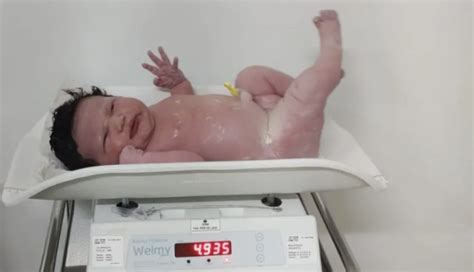 Bebê Nasce Com Quase 5 Kg Em Peruíbe Click Guarulhos