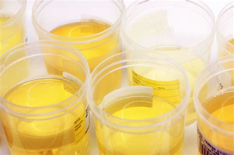 Can Urine Really Clear Acne
